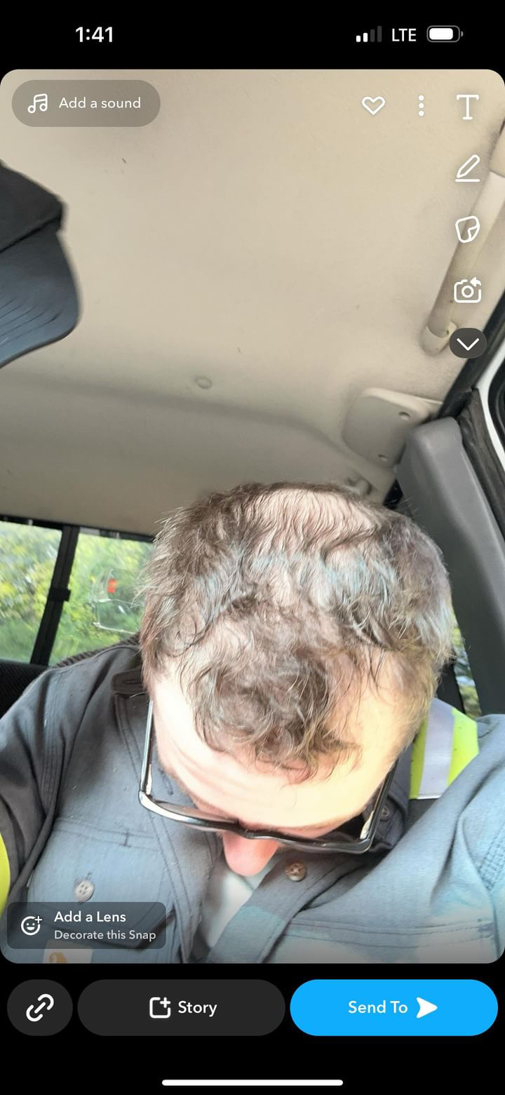 Before treatment