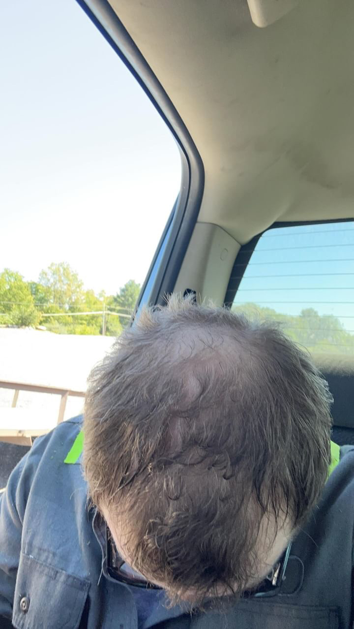 After treatment