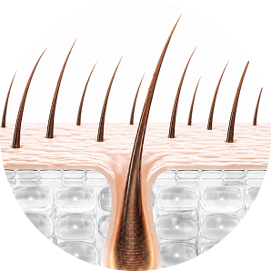 Hair follicle at 3-6 months