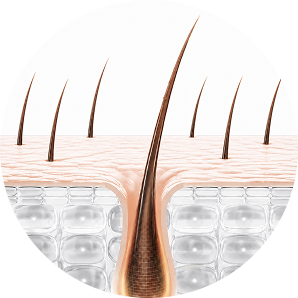 Hair follicle at 2-3 months