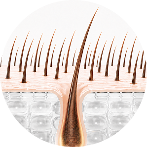 Hair follicle at 6-12 months