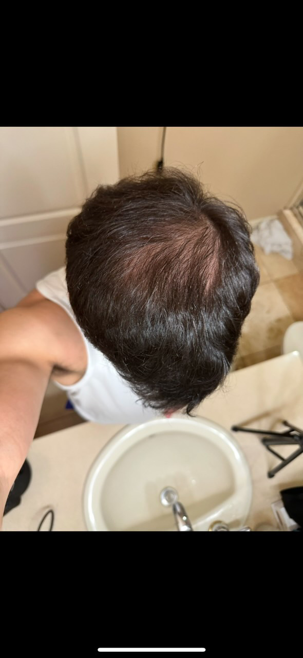 Before treatment