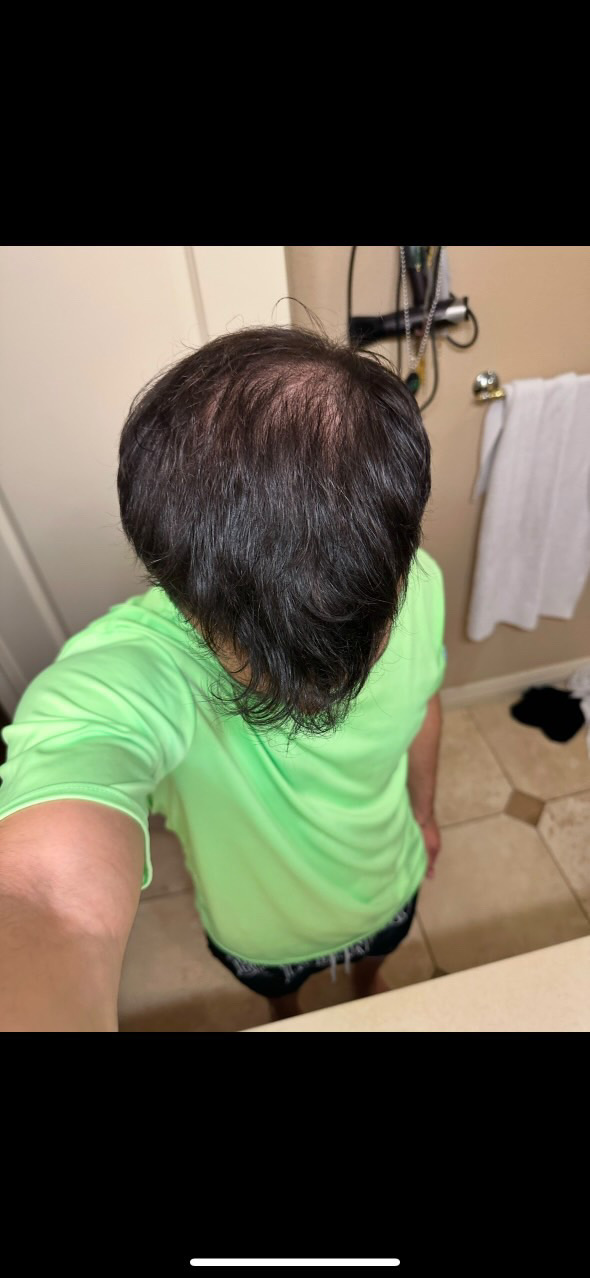 After treatment