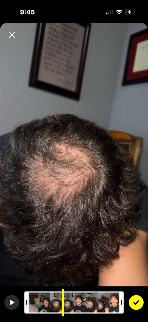 After treatment