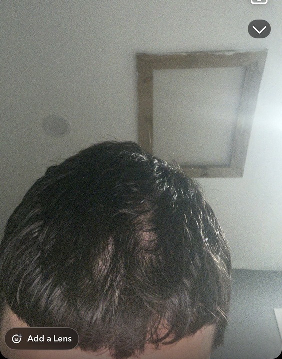 Before treatment