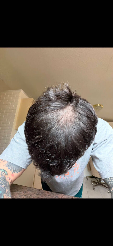 Before treatment